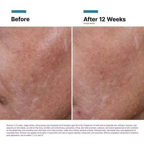 Hyaluronic Acid Intensifier Multi-Glycan